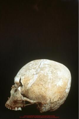 Khirokitia, crânes des sépultures 641 et 545